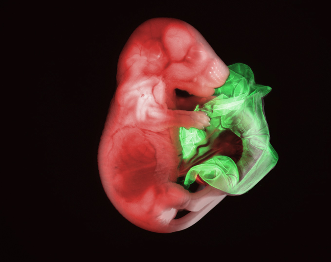 Два трансгенных эмбриона мыши. Зеленым подсвечен второй плод