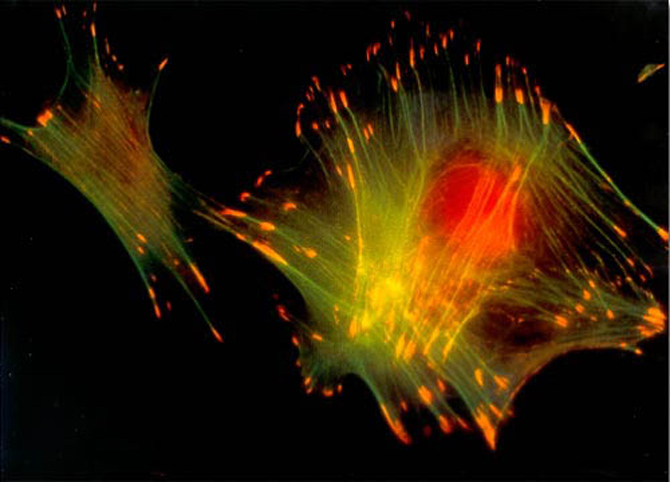 Фибробласты (клетки в соединительных тканях) мыши.
