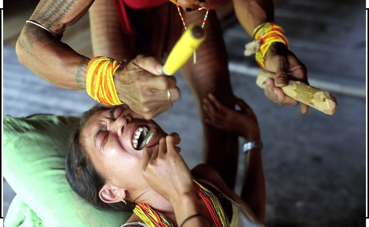 Интересная традиция: заточка зубов в Индонезии