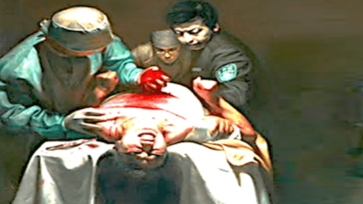 Удаление органов без согласия пациента
